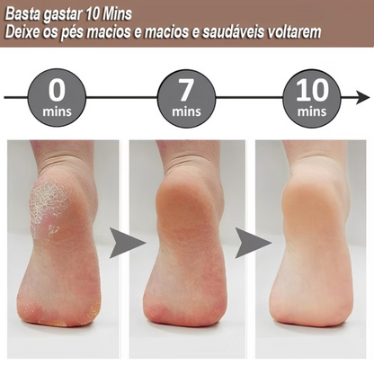 Lixa elétrica de pés recarregável - tira calos